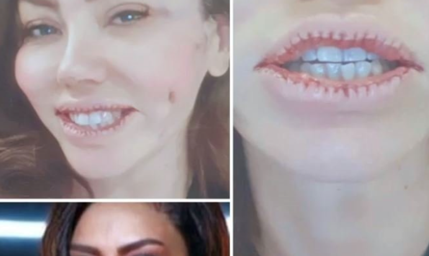 Estetikle Kendi Kendilerini Çirkinleştiren Ünlü İsimler