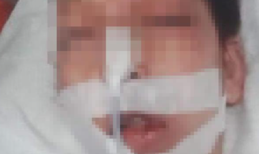 Genç Kızın Başına Taşla Vuran Afganistanlı Yaptıklarıyla Kan Dondurdu