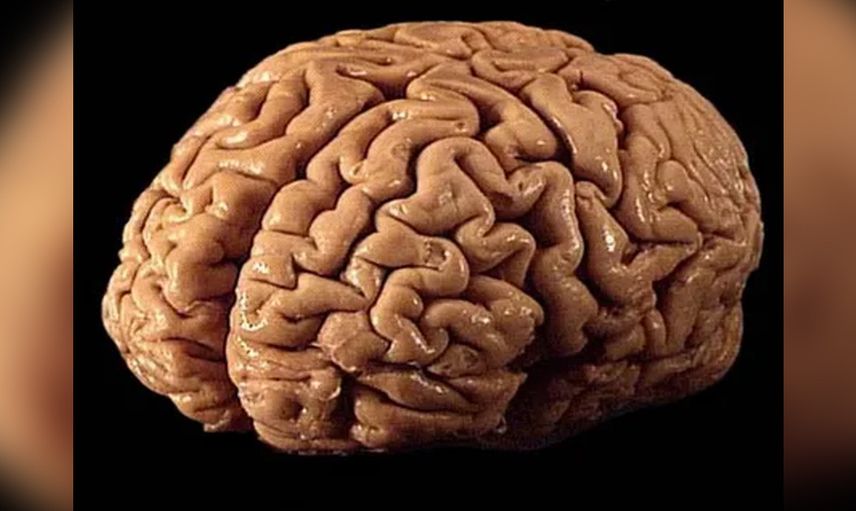 Kovid Geçirenlerde IQ Kaybı Meydana Geliyor