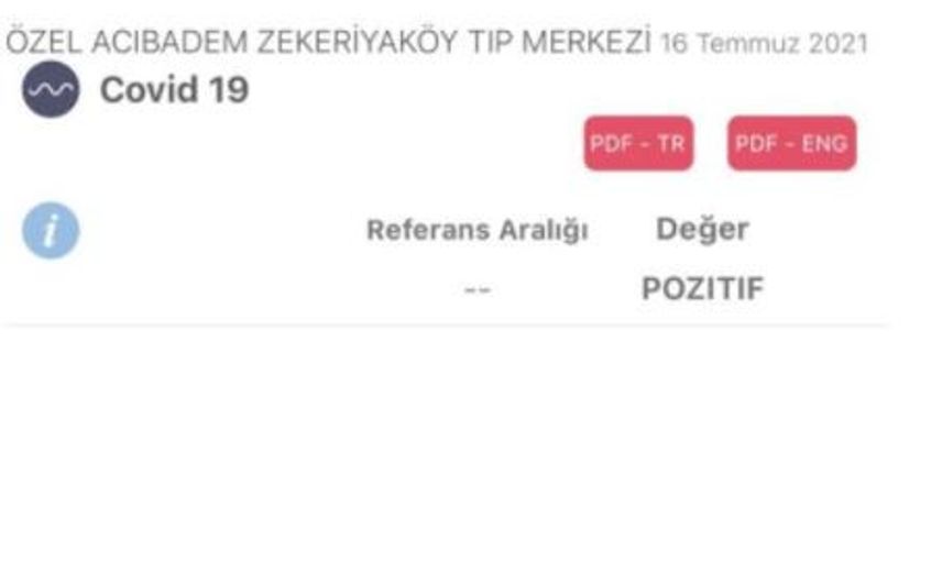 Şarkıcı Aylin Çoşkun'dan Kötü Haber! Koronavirüse Yakalandı