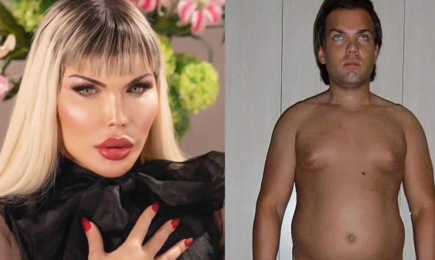 Barbie'nin sevgilisi Ken bebeğe benzemek için ameliyat olan Rodrigo Alves