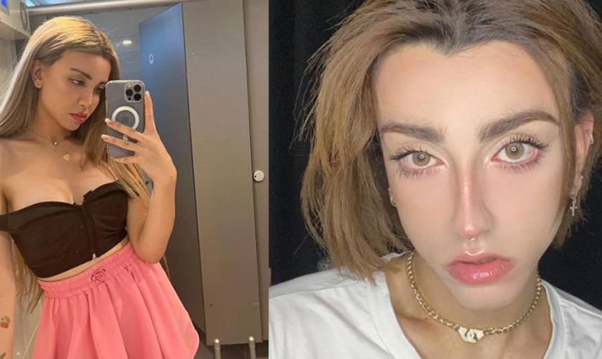 Sosyal medya fenomeni Mika'nın estetiksiz ve estetikli hali gündem olmuştu: Şimdi de Mika'nın bikinili fotoğrafı ortaya çıktı