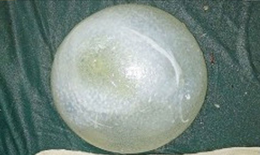 Felçli kızı muayene eden doktor sebebini anlayınca hayret etti