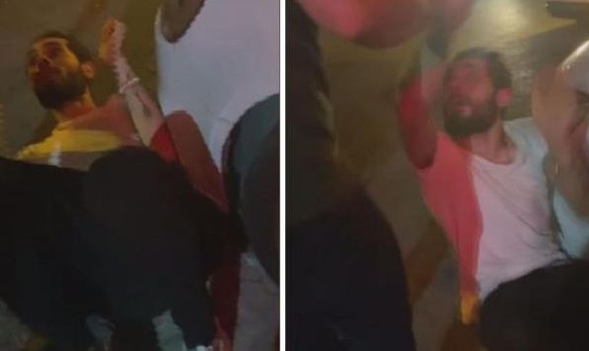 Öz Babası Tarafından Üzerinde Sigara Söndürülen 1,5 Yaşındaki Bebeğin Durumu Kötü!