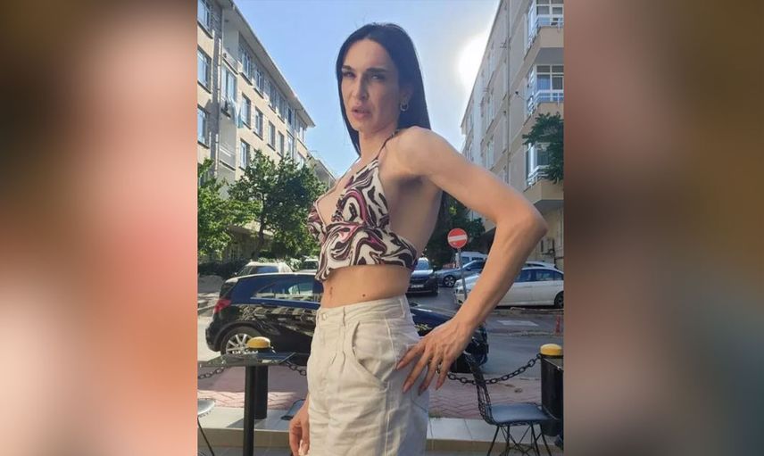 Cinsiyet değiştirme ameliyatı olmuştu Çukur'un Timsah Celil'i Meli Bendeli verdiği pozlarla gündem oldu