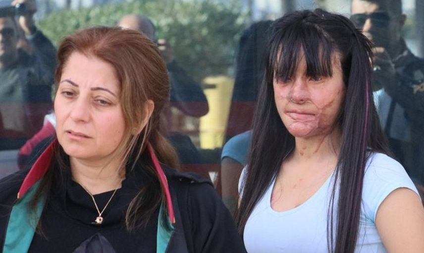 Yüzünü Yakan Kişiyle Evlenen Berfin Özek’in Babası Konuştu