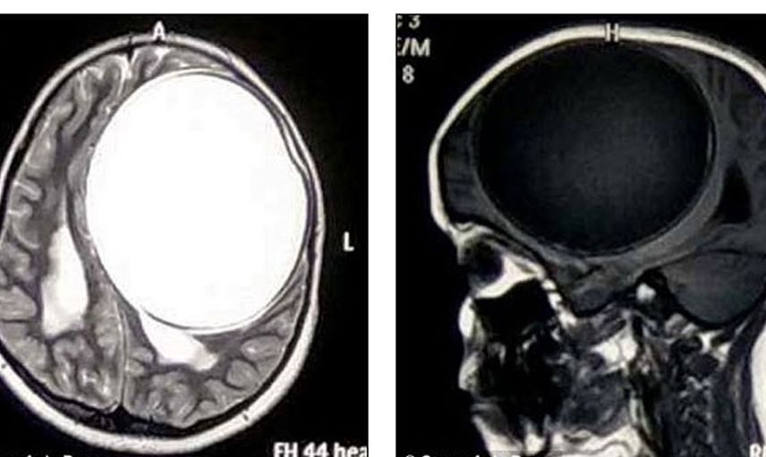 Felçli kızı muayene eden doktor sebebini anlayınca hayret etti
