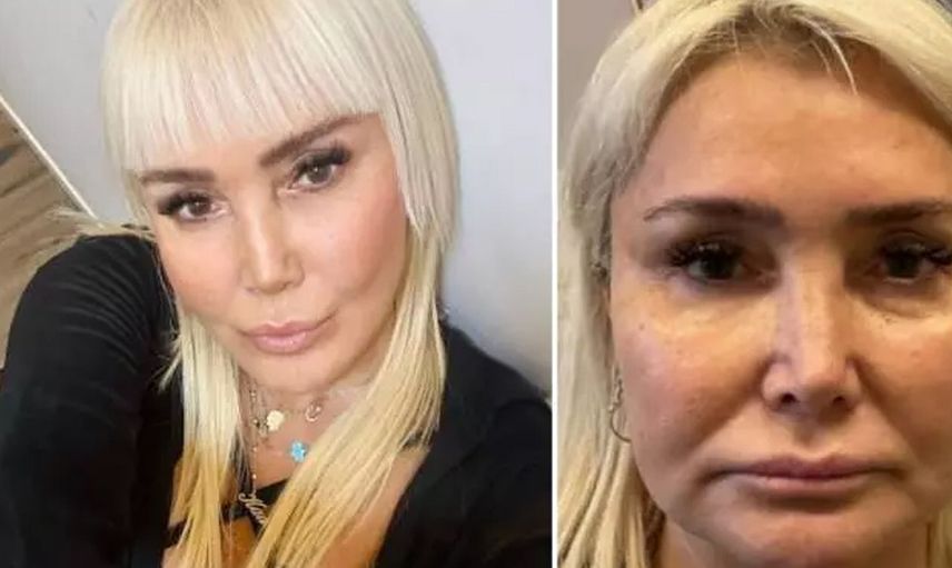 60 yaşındaki Yonca Evcimik estetik yaptırdı! Bambaşka birine döndü: Son hali alay konusu oldu...