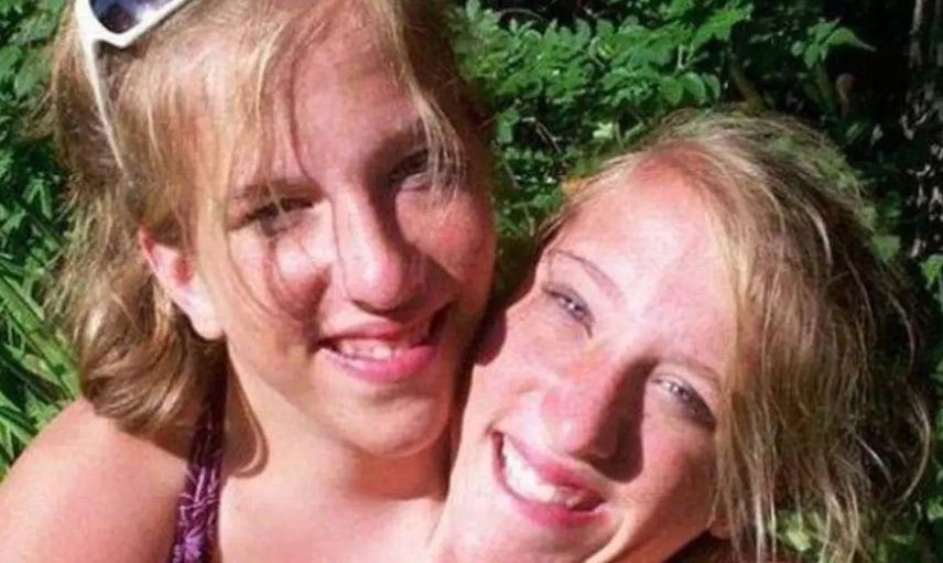 Yaşama şansları yok deniyordu! Yapışık ikizler Abby ve Brittany Hensel ABD'li bir savaş gazisiyle evlendi!