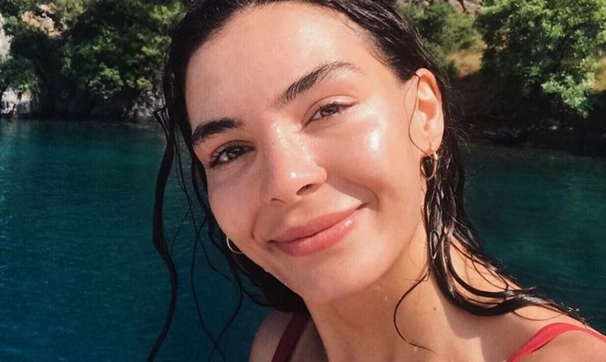 Destan Dizisinin Ebru Şahin’inin Estetiksiz Hali