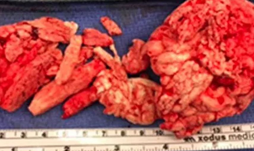 Türlü sex oyuncakları yüzünden sonu hastanelik olan insanlar