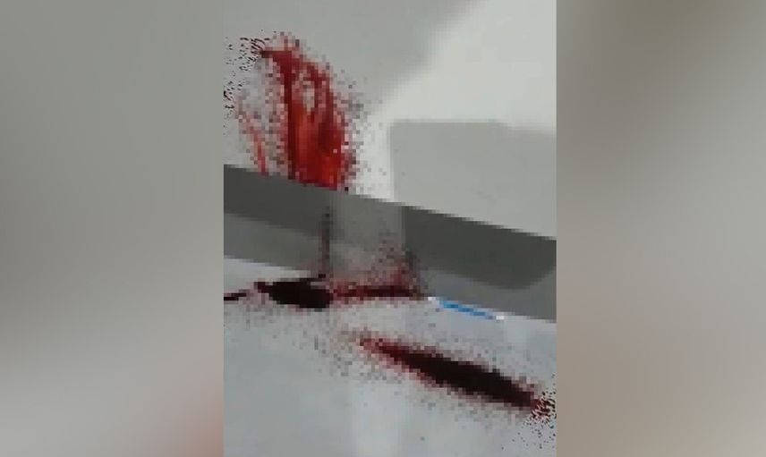 Duvarlardan kan fışkırıyor