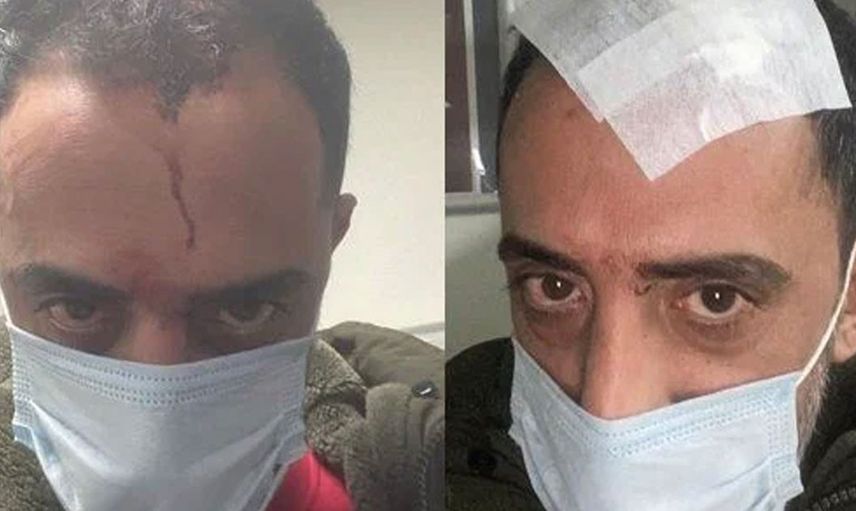 Bu nasıl komşu böyle! Eve taşınanlar bu kişi yüzünden hemen geri taşınıyor