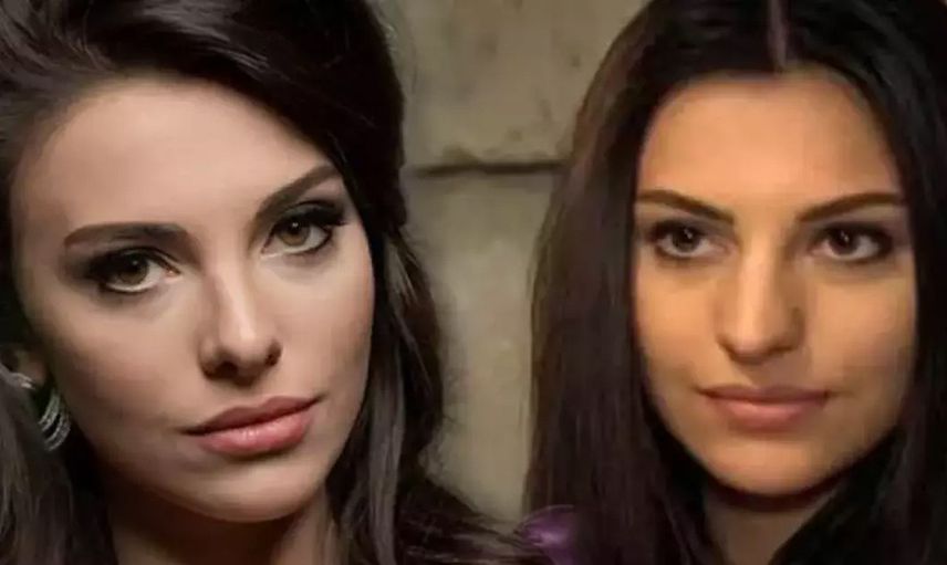 Ünlü oyuncu Tuvana Türkay estetik güzeli çıktı! Estetiksiz halini görenler inanamadı: Ülkeyi terk ederim!