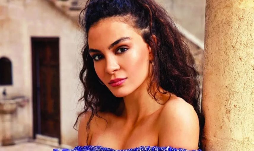 Destan Dizisinin Ebru Şahin’inin Estetiksiz Hali