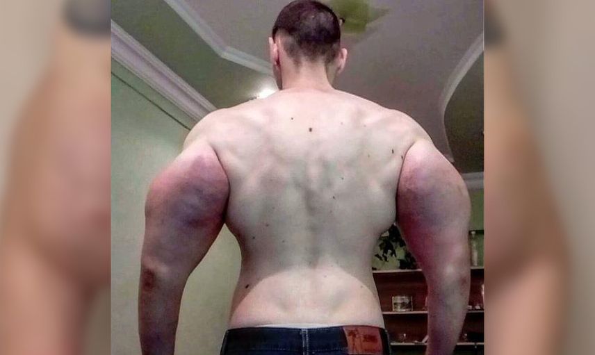 Kirill Tereshin kimdir, kol kasları gerçek mi? Sosyal medya fenomeni Temel Reis’e benzemek için servet harcadı! Kollarını gören şaşırıyor