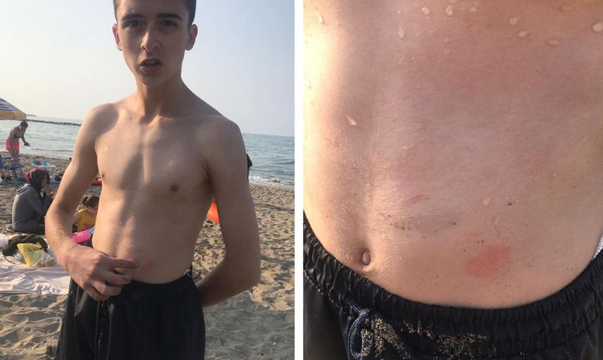 Karadeniz’de Bazı Bölgelerde Denize Girmek Yasaklandı