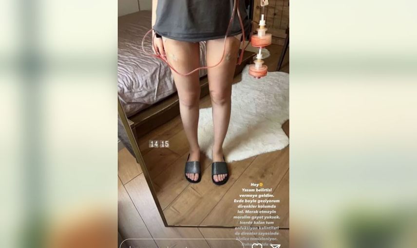 Beren Güney cinsiyet değiştirme ameliyatı sonrası öyle bir poz verdi ki belden aşağısı göründü