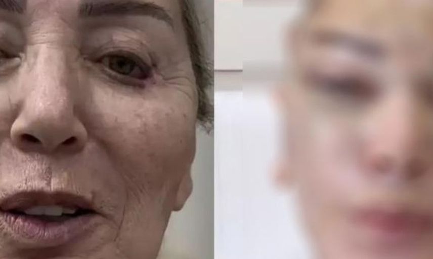 Seda Sayan bu kez de ablasına estetik yaptırdı! Son halini görenler dondu kaldı...