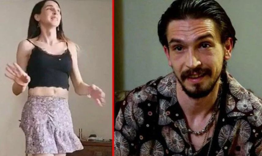 Cinsiyet değiştiren Ahmet Meli Yılmaz'dan mini elbisesiyle cesur pozlar!
