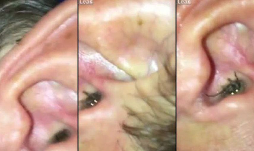 Doktor kadının kulağından çıkan şeyi görünce kendini kaybetti
