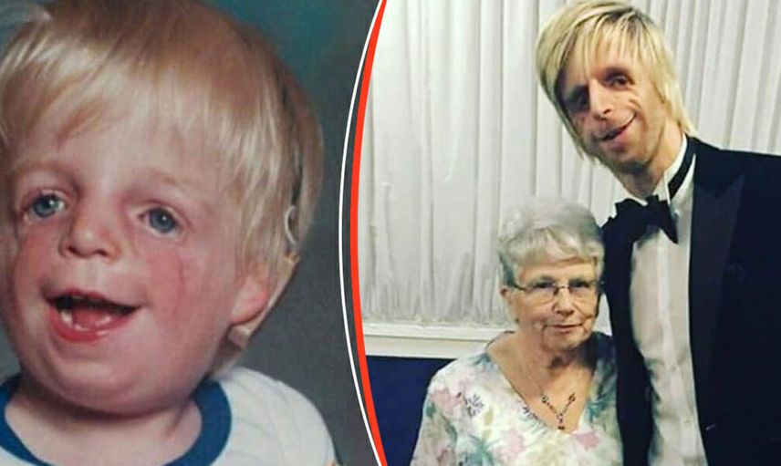 Yeni doğan bebeklerinin yüzünü görünce hastaneden kaçtılar: Jono Lancaster'ın hikayesi herkesi duygulandırdı
