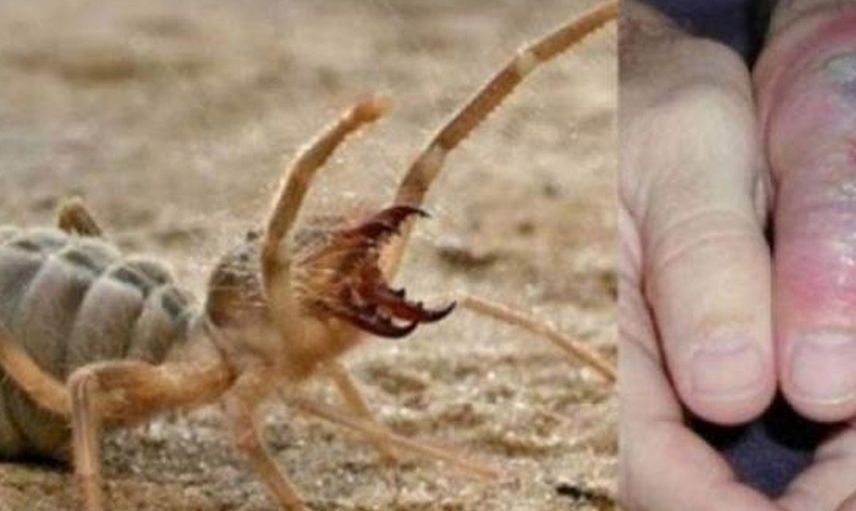 Adıyaman’da zehirli örümcek istilası! Sarıkız örümceği 1 metre zıplıyor ve tek ısırığıyla et koparıyor