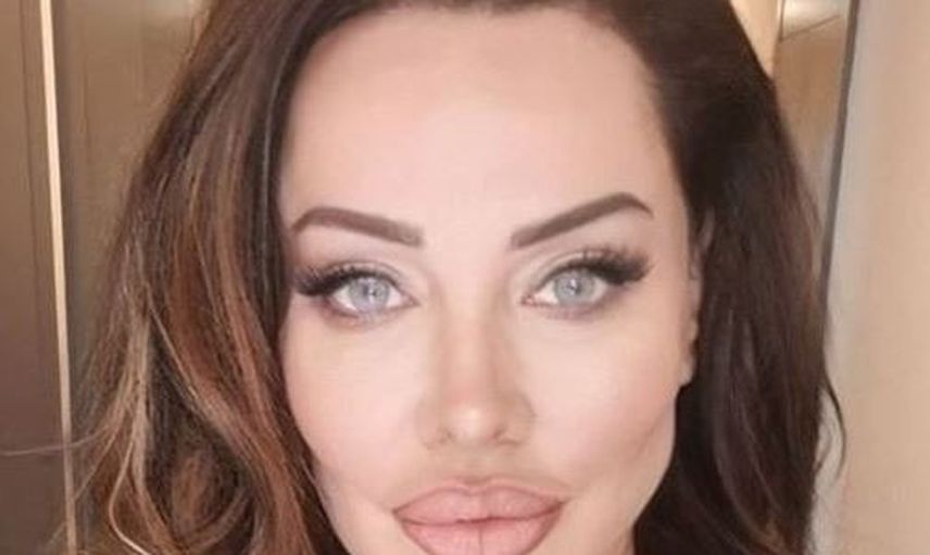 Angelina Jolie'ye Benzemek için Türlü Estetikler Yaptıran Umut Akyürek'in Parmak Isırtan Pozlar