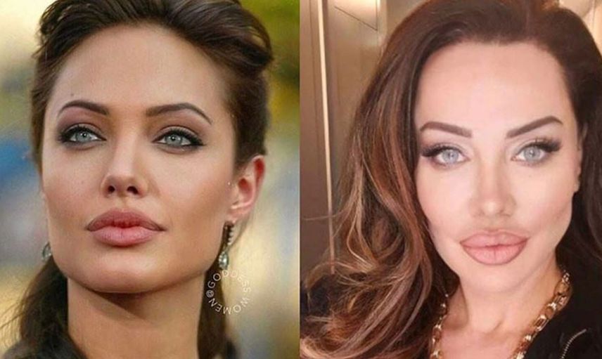 Angelina Jolie'ye Benzemek için Türlü Estetikler Yaptıran Umut Akyürek'in Parmak Isırtan Pozlar