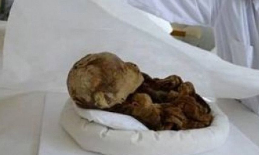 Asırlık cesette öyle bir şey çıktı ki! Bilim adamları gerçek olabileceğine inanmıyor
