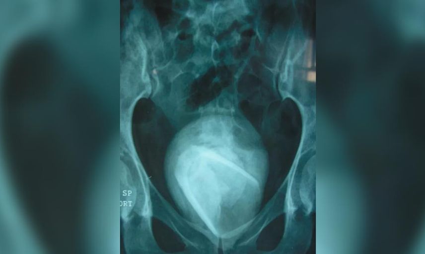 Mesanesinden cam bardak çıktı! 45 yaşındaki kadın az kaslın fantezi uğruna canından oluyordu
