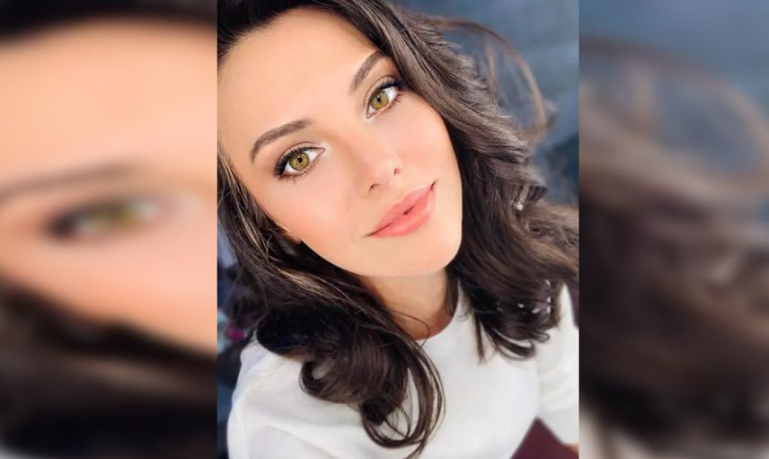 Ünlü oyuncu Tuvana Türkay estetik güzeli çıktı! Estetiksiz halini görenler inanamadı: Ülkeyi terk ederim!