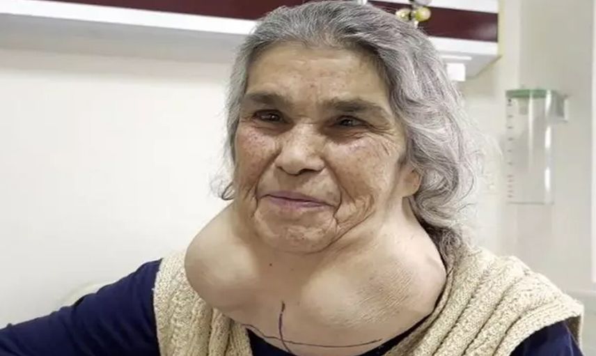 Bu belirtileri yaşıyorsanız dikkat!