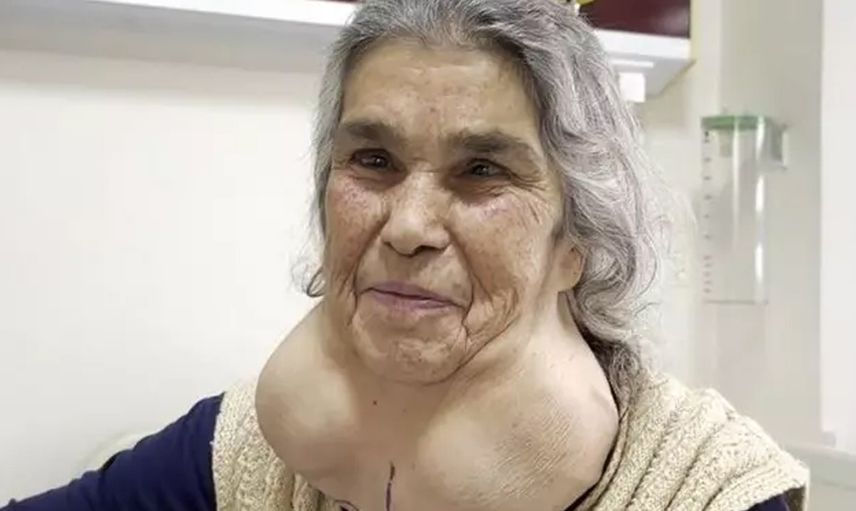 Boynunu gören uzmanlar dondu kaldı: Denizli'de ilginç olay! Doktor korkusuyla hastaneye gitmeyince...