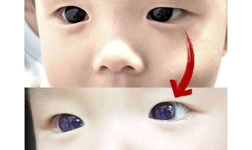 Bilim insanlarını korkutan olay: Küçük çocuğun kahverengi gözleri bir anda parlak maviye dönüştü, nedeni ise…
