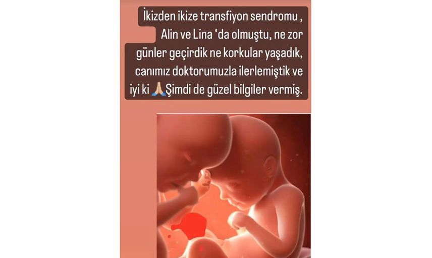 İkiz bebekleri olan Pelin Akil’in zor günleri: ‘Çok korktum’