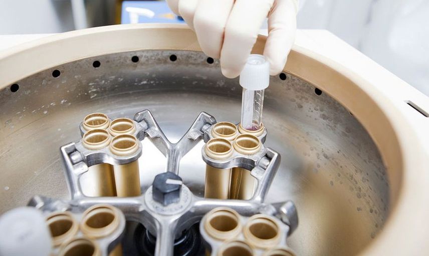 Sperm bankası nedir, Türkiye'de neden yasak?