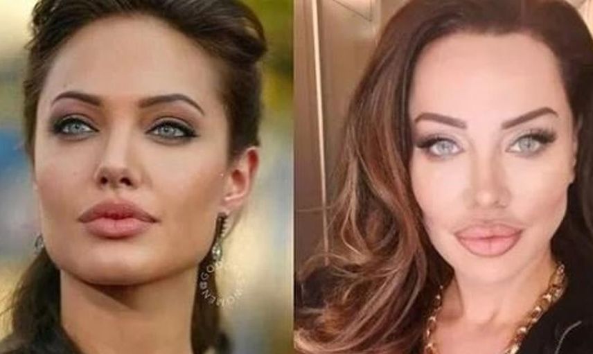 Yerli Adriana Lima Umut Akyürek güzelleşmek için yüzüne sülük yapıştırdı bin pişman olan Akyürek'in o hali herkese ders oldu