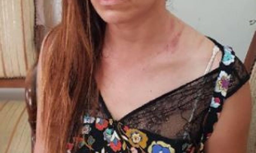 Hatay'da Doktorların Muayene Kavgası Kötü Bitti!
