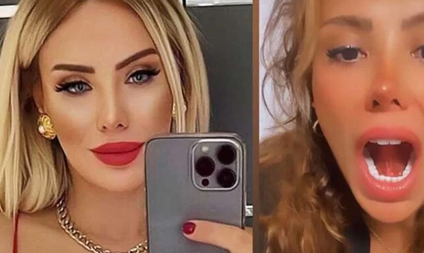 Ceyda Ersoy, öpüşürken kopan dilini diktirdi o videosu olay oldu