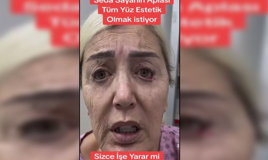 Seda Sayan bu kez de ablasına estetik yaptırdı! Son halini görenler dondu kaldı...