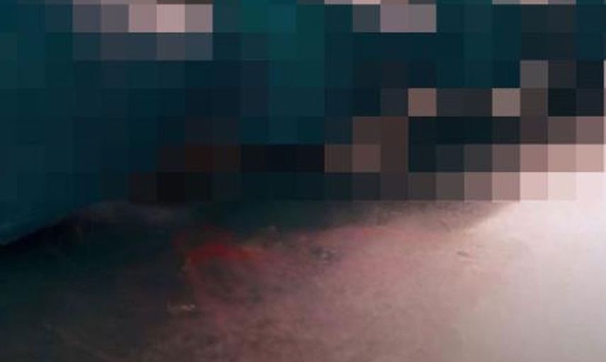 ABD’de bir kadın cinsel ilişki oyuncağı yüzünden ölümden döndü