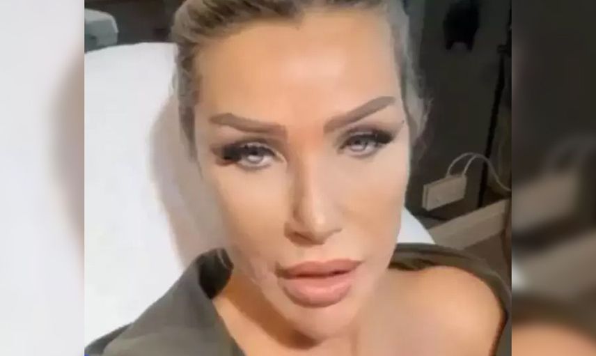 Yüzüne sünnet derisi enjekte etmişti! Seda Sayan'ı öyle bir isim aradı ki: Ben de istiyorum!