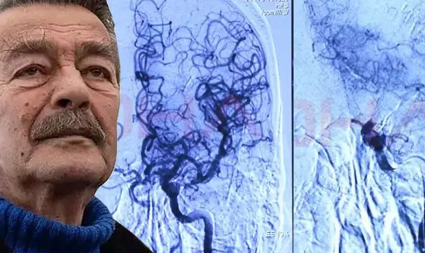 Kadir İnanır ile ilgili son gelişme: Doktoru duyurdu!