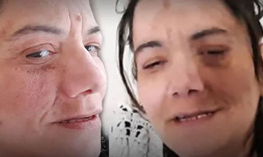 Damak Ağrısı Diye Gitti Yanlış Tedavi Yüzünden Hayatı Karardı