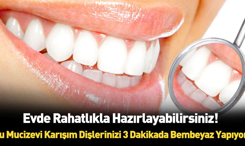 Dişleri 3 dakikada bembeyaz yapan formül