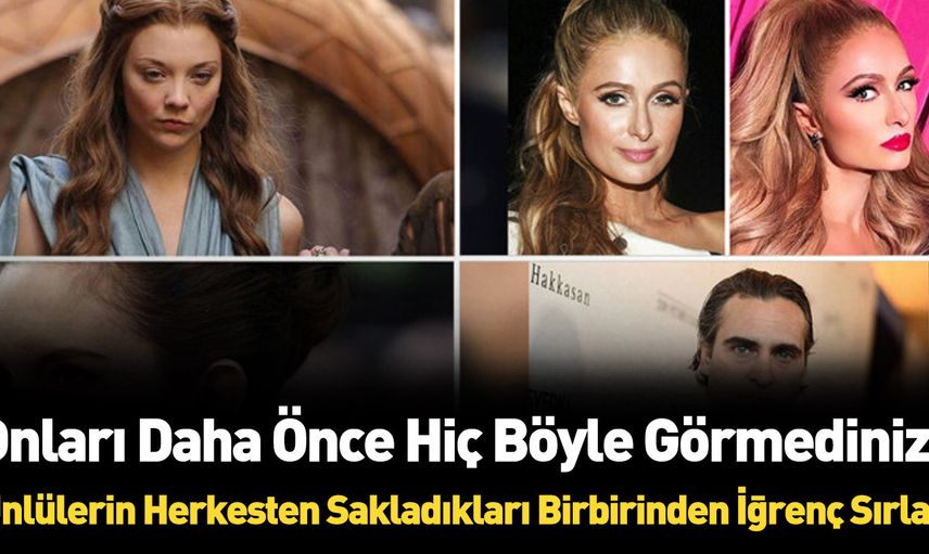 Dünyaca ünlü yıldızların hiç bilinmeyen kusurları