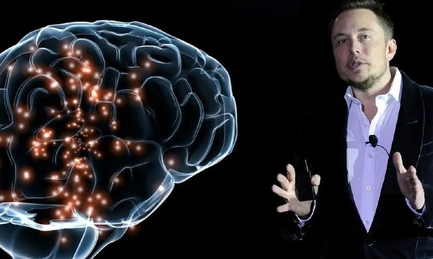 Dünyada ilk kez bir insanın beynine çip takmıştı! Son gelişmeleri açıkladı: Şok olacaksınız!