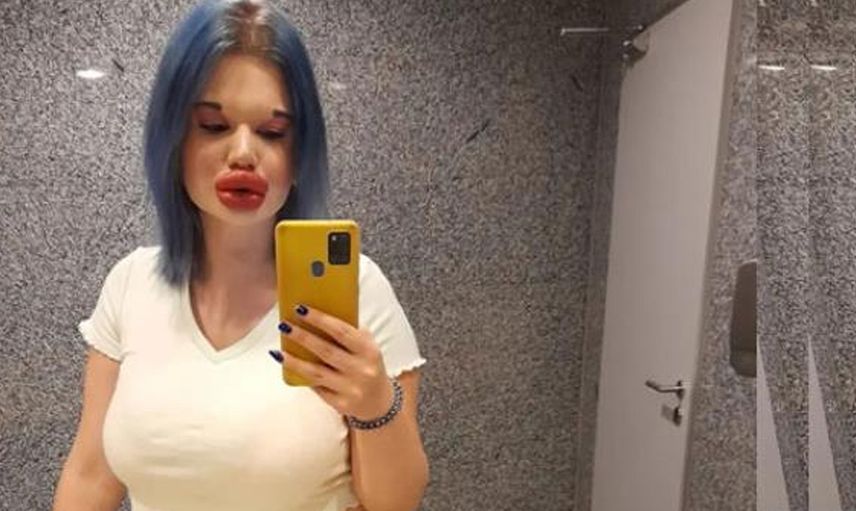 Dünyanın En Büyük Dudaklı Kadını