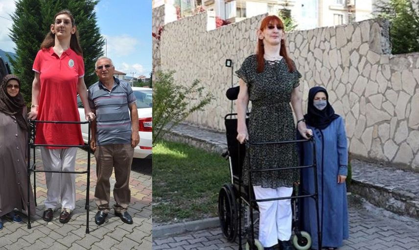 Dünyanın en uzun kadını Rümeysa 3. kez rekorlar kitabına girdi!